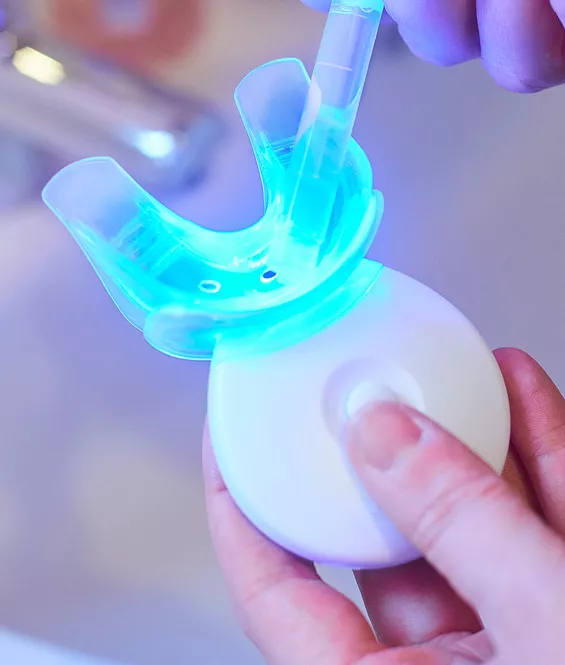 at-home teeth whitening in Edmonton