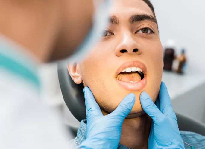 wisdom teeth removal in Edmonton